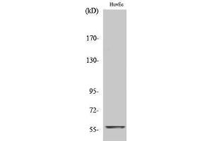 Western Blotting (WB) image for anti-Myc Proto-Oncogene protein (MYC) (C-Term) antibody (ABIN3179963) (c-MYC anticorps  (C-Term))