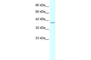 WB Suggested Anti-HMX1 AntibodyTitration: 5. (HMX1 anticorps  (Middle Region))