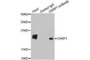 Immunoprecipitation analysis of 200ug extracts of HepG2 cells using 1ug CSRP1 antibody.