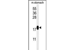 Western blot analysis of TXNDC12 Antibody (C-term) (ABIN651065 and ABIN2840056) in mouse stomach tissue lysates (35 μg/lane). (TXNDC12 anticorps  (C-Term))