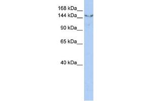 WB Suggested Anti-UGCGL2 Antibody Titration:  0.