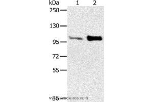 Western blot analysis of Mouse muscle and heart tissue, using ACTN2 Polyclonal Antibody at dilution of 1:300 (ACTN2 anticorps)