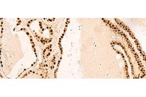 anti-Small Nuclear Ribonucleoprotein Polypeptide B (SNRPB2) antibody
