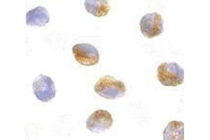 Immunocytochemistry of CARD9 in K562 cells with AP30185PU-N CARD9 antibody at 10 μg/ml.