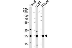 Western Blotting (WB) image for anti-Glutathione S-Transferase mu 1 (GSTM1) antibody (ABIN3002864) (GSTM1 anticorps)