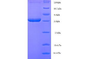 LHPP Protein (AA 1-270, full length) (His-SUMO Tag)