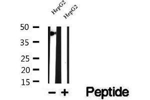 Western blot analysis of extracts of HepG2 cells, using SMYD3 antibody. (SMYD3 anticorps  (N-Term))