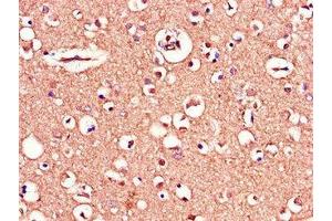 Immunohistochemistry of paraffin-embedded human brain tissue using ABIN7159770 at dilution of 1:100
