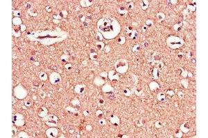 Immunohistochemistry of paraffin-embedded human brain tissue using ABIN7159770 at dilution of 1:100 (MAPT anticorps  (AA 33-166))