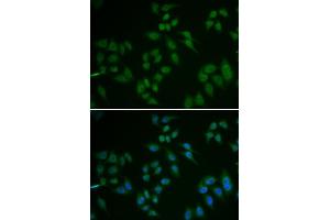 Immunofluorescence (IF) image for anti-Tumor Protein P63 (TP63) (AA 421-680) antibody (ABIN3023012) (p63 anticorps  (AA 421-680))