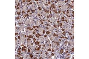 Immunohistochemical staining of human stomach with PLAC9 polyclonal antibody  shows strong cytoplasmic positivity in parietal cells at 1:500-1:1000 dilution. (PLAC9 anticorps)