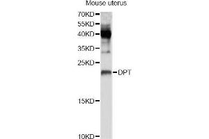 Western blot analysis of extracts of mouse uterus, using DPT Antibody (ABIN5995761) at 1/1000 dilution. (Dermatopontin anticorps)