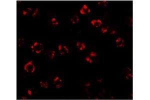 Immunofluorescence of SPT2 in 3T3 cells with SPT2 Antibody at 20 µg/ml.