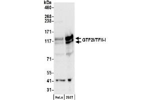 Western Blotting (WB) image for anti-General Transcription Factor III (GTF2I) (C-Term) antibody (ABIN7449365)