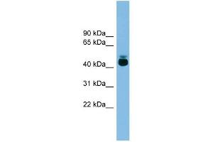 GPR87 antibody used at 1 ug/ml to detect target protein.