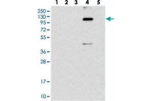 Western blot analysis of Lane 1: RT-4, Lane 2: U-251 MG, Lane 3: Human Plasma, Lane 4: Liver, Lane 5: Tonsil with KIAA1468 polyclonal antibody . (KIAA1468 anticorps)