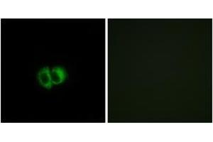 Immunofluorescence analysis of MCF7 cells, using OXER1 Antibody. (OXER1 anticorps  (AA 212-261))