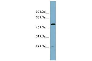 UCHL5IP antibody used at 1 ug/ml to detect target protein. (HAUS7 anticorps  (Middle Region))