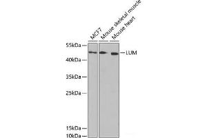 Western blot analysis of extracts of various cell lines using LUM Polyclonal Antibody at dilution of 1:1000. (LUM anticorps)