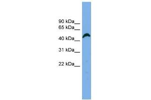 WB Suggested Anti-APBB3 Antibody Titration: 0.