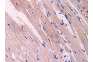 Detection of NOSTRIN in Rat Heart Tissue using Polyclonal Antibody to Nitric Oxide Synthase Trafficker (NOSTRIN)