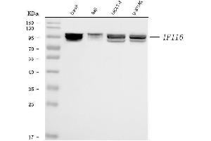 Western blot analysis of IFI16 using anti-IFI16 antibody (ABIN7600373).