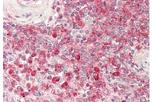 Rabbit Anti-PTDSS1 antibody  Formalin Fixed Paraffin Embedded Tissue: Human Spleen Primary antibody Concentration: 1:100 Secondary Antibody: Donkey anti-Rabbit-Cy3 Secondary Antibody Concentration: 1:200 Magnification: 20x Exposure Time: 0.