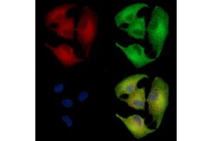 ABIN6259435 and ABIN6276265 staining  cells by IF/ICC.