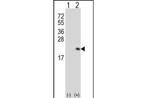 Western blot analysis of RFK (arrow) using rabbit polyclonal RFK Antibody (C15) (ABIN391271 and ABIN2841321).