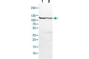 Western Blot (Cell lysate) analysis with USP4 polyclonal antibody  Lane 1: NIH-3T3 cell lysate (Mouse embryonic fibroblast cells) Lane 2: NBT-II cell lysate (Rat Wistar bladder tumour cells)
