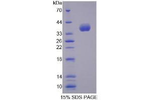 SDS-PAGE analysis of Mouse ALOX12B Protein. (ALOX12B Protéine)