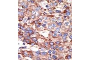 Image no. 2 for anti-YY1 Transcription Factor (YY1) (Middle Region) antibody (ABIN357757) (YY1 anticorps  (Middle Region))