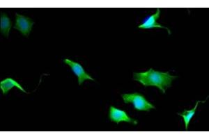 Immunofluorescence staining of SY5Y Cells with ABIN7127838 at 1:50, counter-stained with DAPI. (Recombinant TPT1 anticorps)