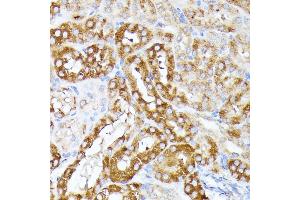 Immunohistochemistry of paraffin-embedded mouse kidney using CLNS1A antibody (ABIN7266334) at dilution of 1:100 (40x lens).