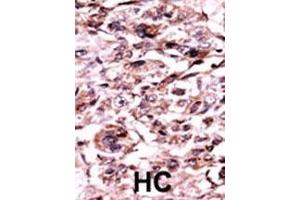 anti-C-Abl Oncogene 1, Non-Receptor tyrosine Kinase (ABL1) (pTyr245) antibody