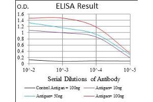 anti-Melanoma Cell Adhesion Molecule (MCAM) (AA 84-189) antibody