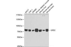 Western blot analysis of extracts of various cell lines using GPD2 Polyclonal Antibody at dilution of 1:1000. (GPD2 anticorps)