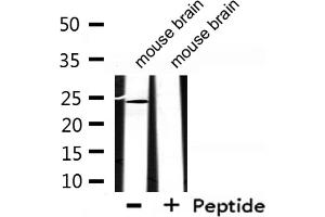 Western blot analysis of extracts from mouse brain, using EFNA2 Antibody. (Ephrin A2 anticorps  (N-Term))