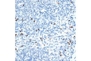 Immunohistochemistry of paraffin-embedded rat spleen using MMP9 antibody (ABIN6131951, ABIN6143920, ABIN6143923 and ABIN6213777) at dilution of 1:100 (40x lens).