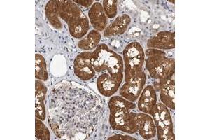Immunohistochemical staining of human kidney with FBXO43 polyclonal antibody  shows distinct cytoplasmic positivity in cells in tubules. (FBXO43 anticorps)