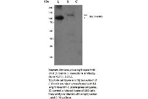10% SDS-PAGE stained with Coomassie Blue, immunoblot with anti-KAL1 monoclonal and peptide fingerprinting by MALDI-TOF (Humain KAL1 Overexpression lysate product)