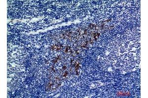 Immunohistochemistry (IHC) analysis of paraffin-embedded Human Tonsils, antibody was diluted at 1:200. (CMTM8 anticorps)