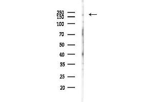 Western blot analysis of lysates from EC304 cells(heat-shock,45 min treatment), using PTPRK Antibody at 1/1000 dilution.
