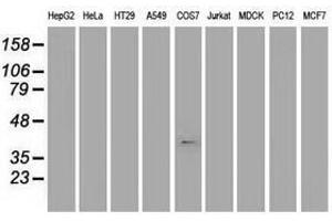 Image no. 1 for anti-Musashi Homolog 1 (Drosophila) (MSI1) antibody (ABIN1499571) (MSI1 anticorps)