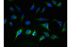 Immunofluorescent analysis of A549 cells using ABIN7170191 at dilution of 1:100 and Alexa Fluor 488-congugated AffiniPure Goat Anti-Rabbit IgG(H+L) (SLC25A36 anticorps  (AA 58-110))