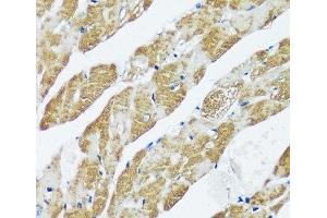 Immunohistochemistry of paraffin-embedded Mouse heart using CASQ2 Polyclonal Antibody at dilution of 1:100 (40x lens). (CASQ2 anticorps)