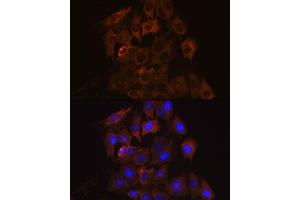 Immunofluorescence analysis of C6 cells using UPF1/RENT1 Rabbit mAb (ABIN7271226) at dilution of 1:100 (40x lens). (RENT1/UPF1 anticorps)