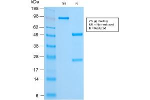 SDS-PAGE Analysis Purified FOXA1 Rabbit Recombinant Monoclonal Antibody (FOXA1/2230R). (Recombinant FOXA1 anticorps  (AA 372-472))
