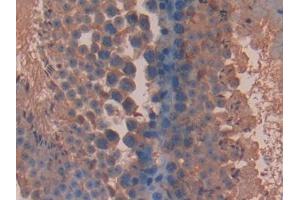 DAB staining on IHC-P; Samples: Mouse Testis Tissue