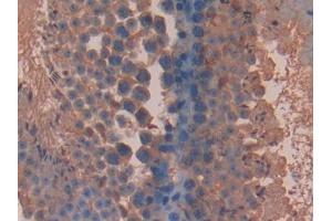 DAB staining on IHC-P; Samples: Mouse Testis Tissue (BLMH anticorps  (AA 27-164))